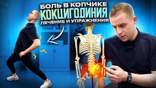картинка: Боль в копчике - кокцигодиния . Лечение и упражнения .