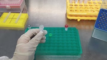 Novel Coronavirus (SARS-CoV-2)Fast Nucleic Acid Detection Kit Operation Vedio(Extraction Free)