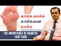 Diabetes foot care 2020        dr sivaprakash