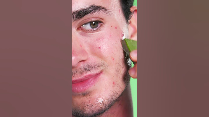 Did You Know Aloe Vera Removes Pimples? #shorts #beautyhacks #lifehack #pimple #aloevera #skincare