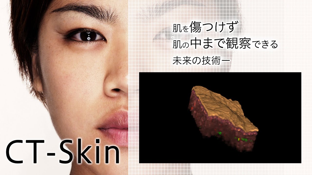 花王 皮膚を切らずに肌の内部を3dで見られる Ct Skin Impress Watch