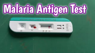 Malaria Antigen Test | How to Perform Malaria Antigen Test