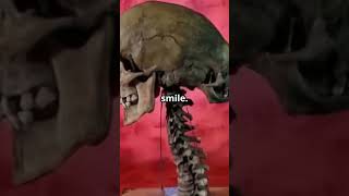 Edward Mordrake: The Man with Two Faces