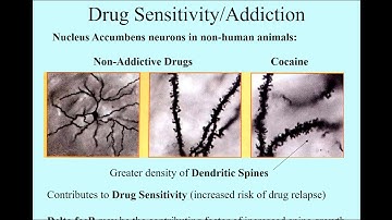 DrugSensitivitySpines