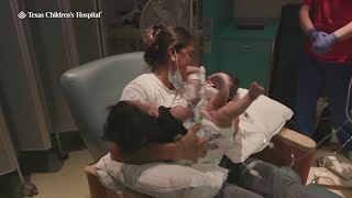Formerly conjoined twin boys doing well after separation surgery at TCH in Houston
