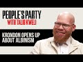 Krondon Gets Raw About The "Divine Blessing" Of Albinism & Racism He's Faced | People's Party Clip