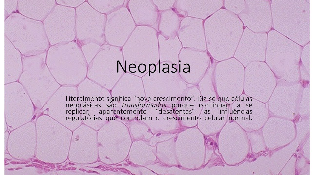 Neoplasia