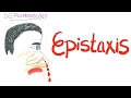 Epistaxis (nosebleed); Causes and Management