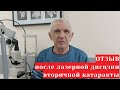 Лазерная дисцизия вторичной катаракты: отзыв после операции у офтальмолога Дмитрия Сагоненко Москва