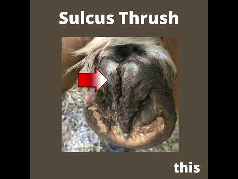 Actual NO THRUSH customer photos  of sulcus thrush