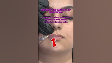 3 tips for creating beautiful lip results