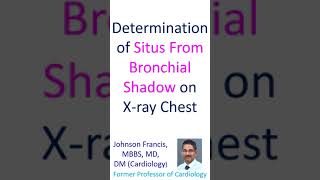 Download Lagu Determination of Situs From Bronchial Shadow on X ray Chest MP3 Download Lagu Determination of Situs From Bronchial Shadow on X ray Chest MP3