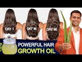 Powerful Hair Growth Oil | Aloe vera Hair Oil  To Promote Hair Growth