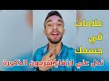 علامات بتدل علي ارتفاع هرمون التيستوستيرون اكتب عندك كام علامة منهم علامات بتدل علي ارتفاع هرمون التيستوستيرون اكتب عندك كام علامة منهم