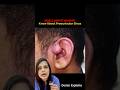 Small ear pits in kids #entdoctor #drnalliramya #doctor #vizagent #telugudoctor #doctoradvice #ent