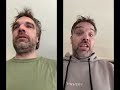 Peer Support Buddy | Finding Your Fellow Patient (Dutch / Nederlands)