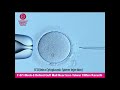 Ivf  icsi fertilization by pakistan best embryologist  australian concept fertility centre karachi