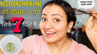 REGROW RECEDING HAIRLINE NATURALLY | Thinning Hairline को दोबारा उगाएं सिर्फ 7 दिनों में