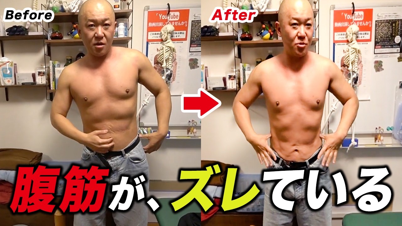 【東大前仕術】バーベルが担げない…腹筋が左右にズレた重症患者。20年の歪みを戻したら「足のサイズまで変わった?」驚愕の結末