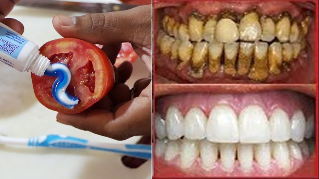 health tips in spanish Magical Teeth Whitening Remedy, Toothpaste Tomatoes Mixed Scrub Face Beauty Tips