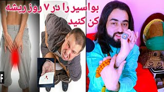 بواسیر را در ۷ روز ریشه کن کنید، درمان طب سنتی هند برای هموروئيد خونی و بادی، اوتار ظریف بابا