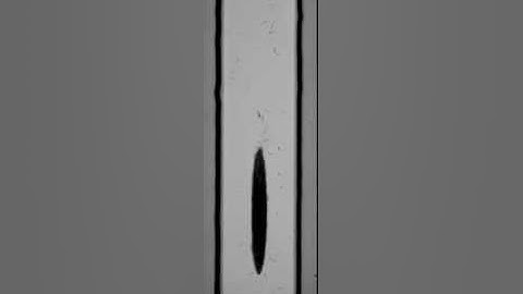 Continuous enrichment of trypanosomes by acoustic trapping of blood cells (acoustic sorting)