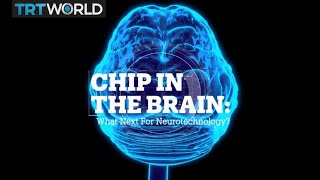 BRAIN IMPLANTS: What next for neurotechnology