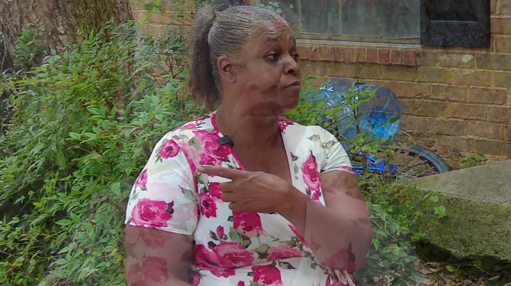 Carol Knight's Story