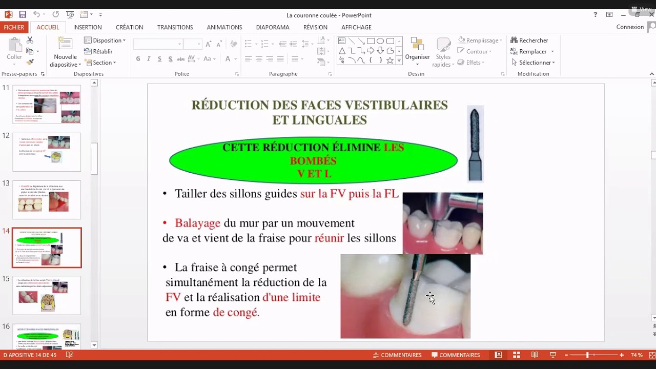 les preparations pour ancrages