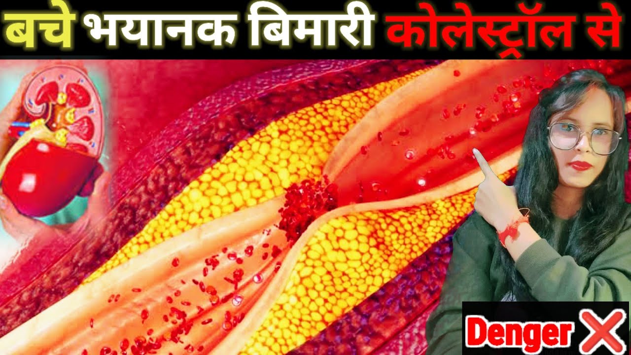 कोलेस्ट्रॉल बढ़ने के सब से आम लक्षण Cholesterol Badhne Ke Lakshan Kya
