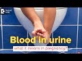 What causes blood in urine during pregnancy? Can it affect pregnancy? - Dr.Shirin Venkatramani of C9