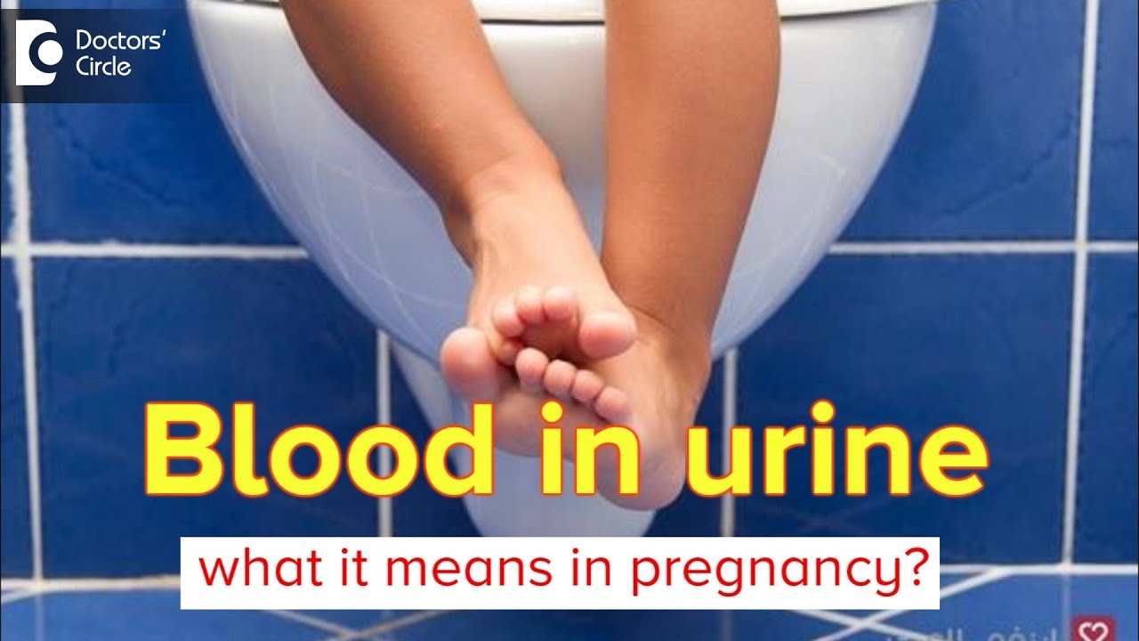 What causes blood in urine during pregnancy? Can it affect pregnancy? -  Dr.Shirin Venkatramani of C9 