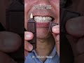 Satisfying Chewing ASMR #Compilation #ASMR #DoctorTristanPeh