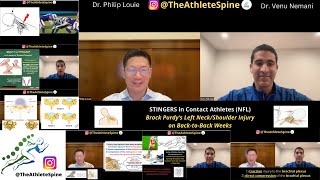 Stingers in Contact Athletes - What did SF 49ers QB, Brock Purdy, suffer back-to-back weeks?