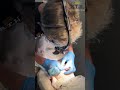 Пересадка волос: сколько дней живут выделенные волосы  #realtranshair #пересадкаволосмосква