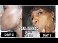 I TRIED SEA MOSS ON MY FACE FOR 5 DAYS AND THIS HAPPENED | COLLAGEN BOOSTER | Mel's World