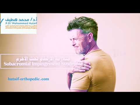 متلازمة انحشار الكتف