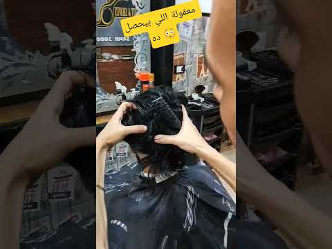 علاج نهائي للصلع بكل درجاته زراعة الشعر تريند