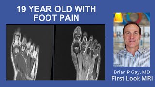 19 year old with foot pain