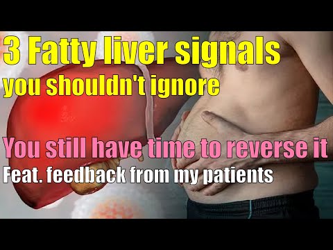 Fatty Liver: 3 Symptoms, Solutions x Supplements Revealed!