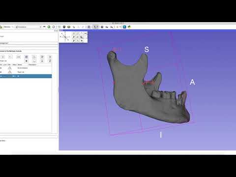 Using 3D Slicer to take linear measurements from an STL file