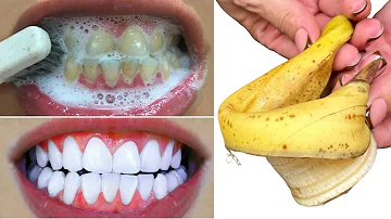 Fast TEETH WHITENING in 1 minute! 🌟 PEARL WHITE SMILE guaranteed! 😁✨Removes tartar!