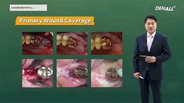 [OSSTEM] Master Course: BASIC Considerations for Successful GBR