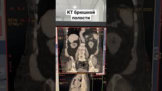 Брюшная полость(поджелудочной железы,печени,толстой и тонкой кишки,желудка,селезенки,желчного пузырь