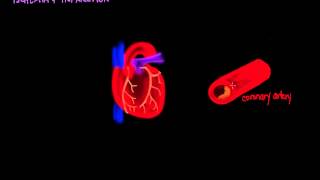 Ischemia and Infarction