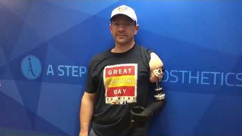 Osseointegration for Above The Elbow Amputation