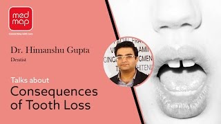 Consequences of Tooth Loss