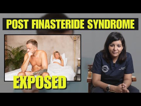 Post Finasteride Syndrome EXPOSED What's REALLY Happening