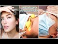 TRANSFORMATION PART 2! BROW REMOVAL & MORE! i'm actually quite concerned this time... | Hannah Renée