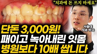 &quot;집에서 치석 싹 없어져요&quot; 평생 치과에 돈 아끼고 녹아내린 잇몸병 낫는 최고의 양치질 방법 (정준홍 원장 1부)